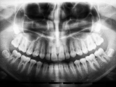 Boost Your Retail Grand Opening Success with these Effective PR Tactics for Yishuns Dental Industry
